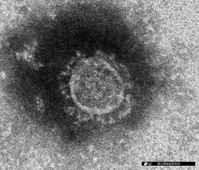 新型コロナウイルス写真　出典：国立感染症研究所ホームページ