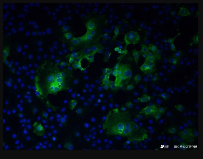 提供：国立感染症研究所　緑色に光る像がウイルスと反応した抗体を、青色に光っているのは細胞核　　
